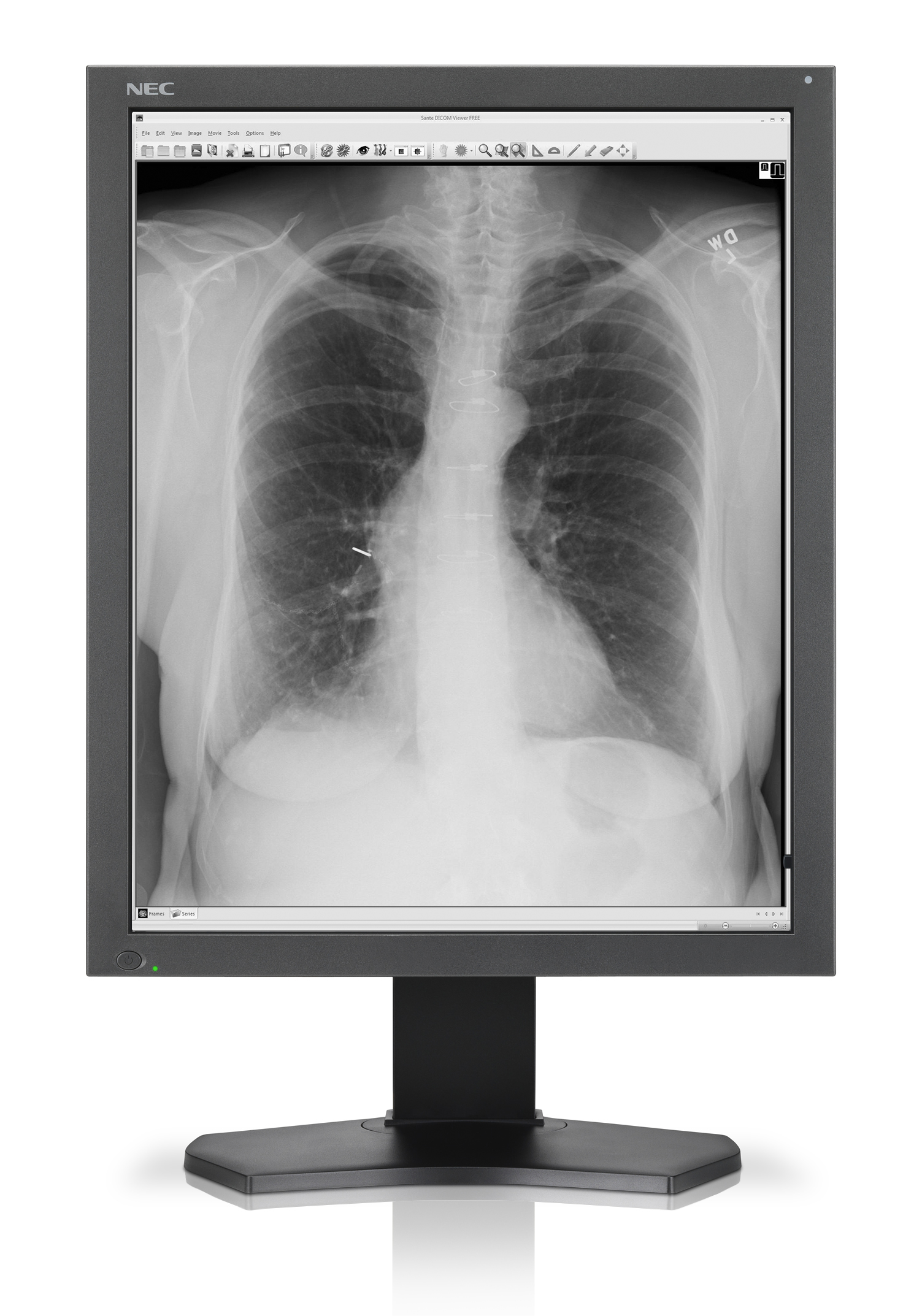 Medical imaging, refertazione accurata con il nuovo display NEC Top Trade
